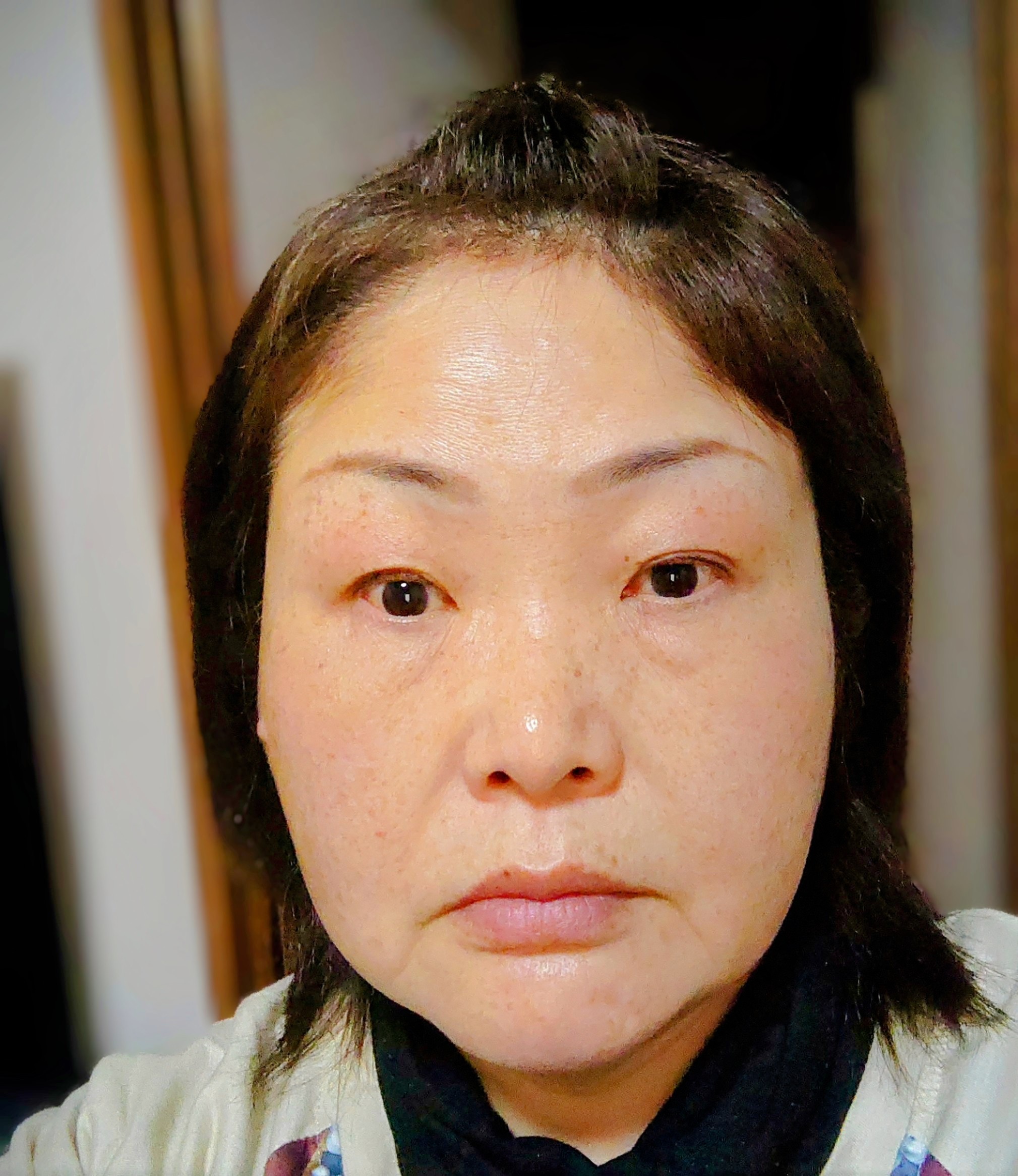 After